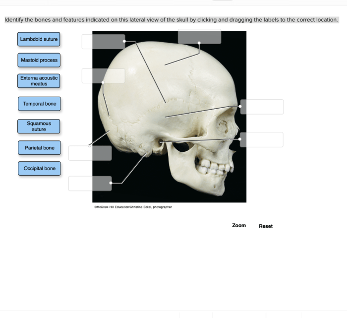 Identify the bones indicated in figure 13.2