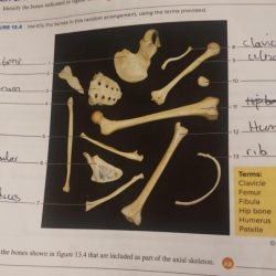 Identify the bones indicated in figure 13.2