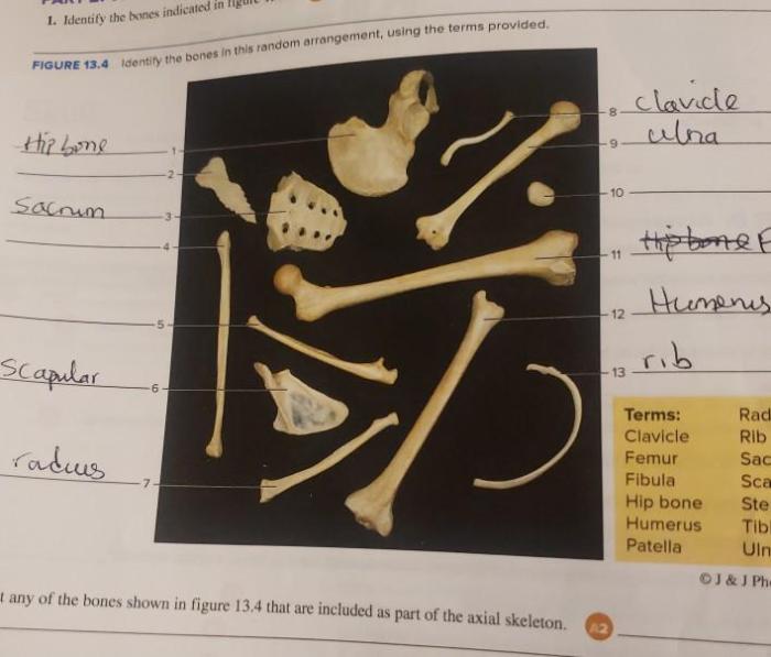 Identify the bones indicated in figure 13.2